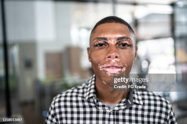 portrait of a young businessman - vitiligo stock pictures, royalty-free photos & images