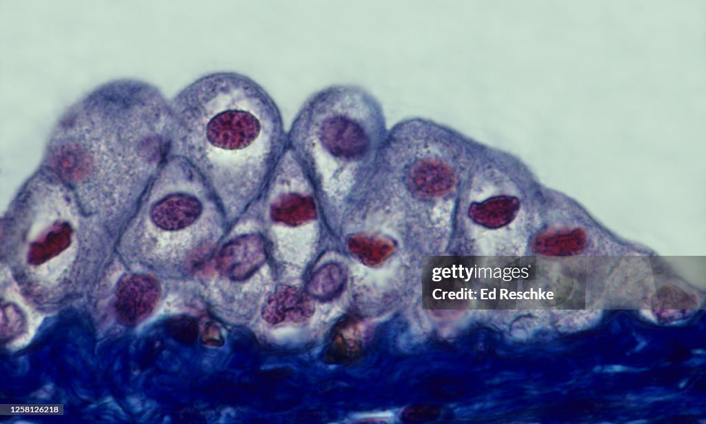 TRANSITIONAL EPITHELIUM lining the URINARY BLADDER--THE CELLS NEAR THE SURFACE ARE PLUMPER WHEN THE BLADDER IS NOT STRETCHED (Lower volume of Urine) 400X