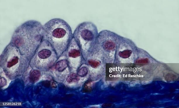 transitional epithelium lining the urinary bladder--the cells near the surface are plumper when the bladder is not stretched (lower volume of urine) 400x - transitional epithelium stock pictures, royalty-free photos & images