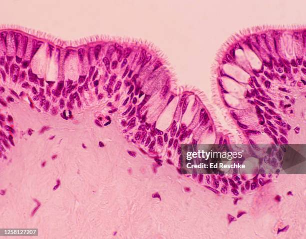 pseudostratified ciliated columnar epithelium with numerous goblet cells lining the trachea, 100x - traquea fotografías e imágenes de stock