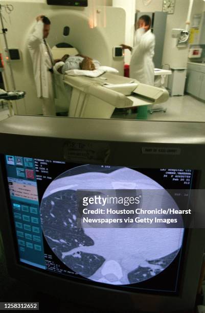 Vanessa Owens, lies in the MRI while technician help her out of the machine. In the foreground is the image of her lung, which shows the suspicious...