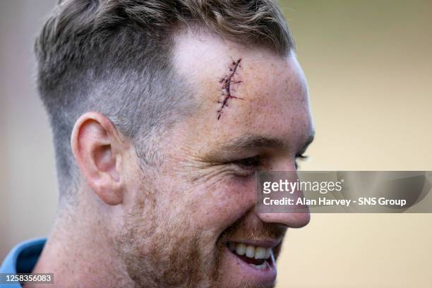 Ross County's Jordan White with extent of his head injury during a cinch Premiership play-off final first leg match between Partick Thistle and Ross...