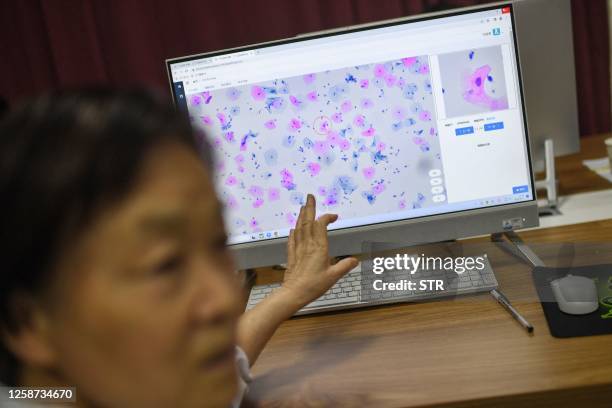 This photo taken on June 15, 2023 shows a laboratory technician conducting artificial intelligence -based cervical cancer screening at a test...