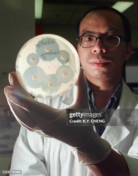 Ho Po-on, a medical technologist at Queen Mary hospital, Hong Kong, holds 23 February, a drug-resistant Staphylococcus aureus culture, a new superbug...