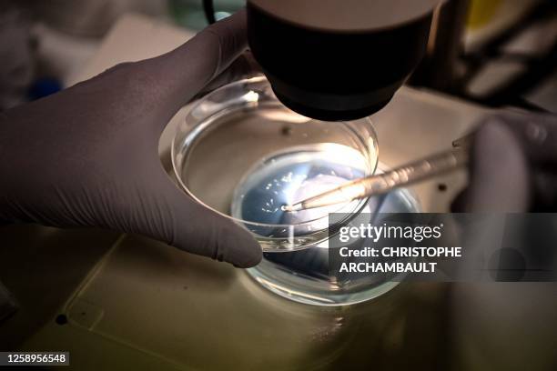 This picture shows zebra fish larvae through a microscope before a scientist injects tumour cells into their brains in a laboratory at the Pasteur...