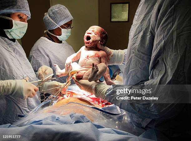 caesarian baby's first breath - family photo in the delivery room stock-fotos und bilder