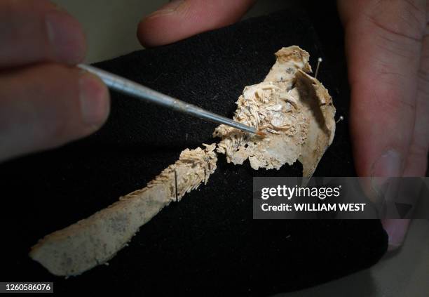 Dr John Long, Head of Sciences at Museum Victoria, points out the umbilical cord on the fossil as the Museum unveils the fossilised remains of the...