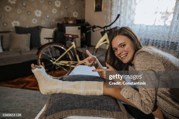 mujer joven con la pierna rota y el pie de yeso en casa - pierna fracturada fotografías e imágenes de stock