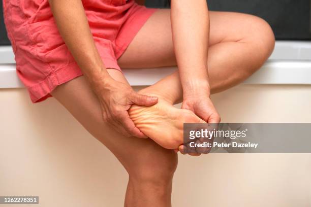 woman massaging foot - swollen ankles 個照片及圖片檔