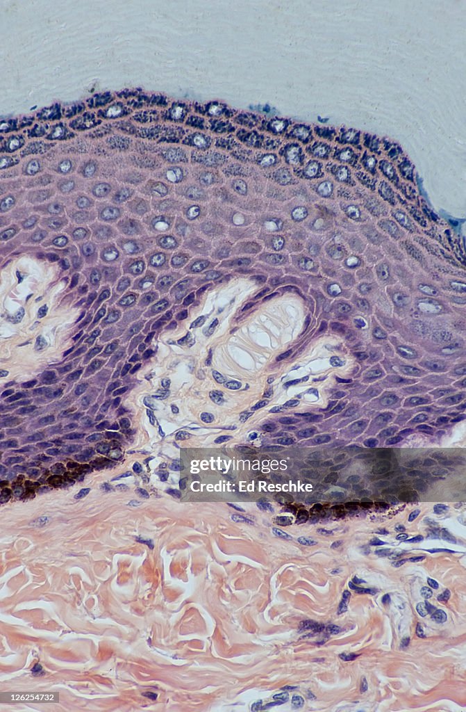 Human Skin, Epidermal Layers, Meissner's Corpuscle