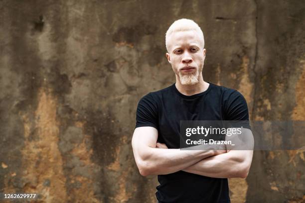 albino afrikanischen mann in schwarzem t-shirt, blick auf die kamera - albino man stock-fotos und bilder