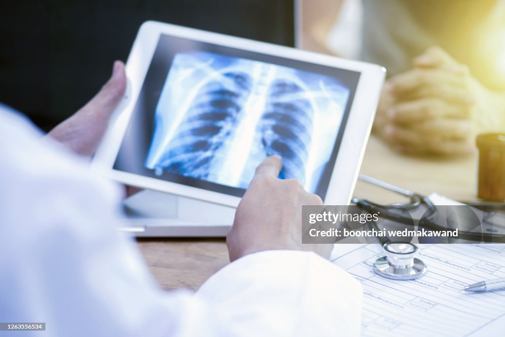 Doctor looking at x-ray of lungs and writing diagnosis Metadata