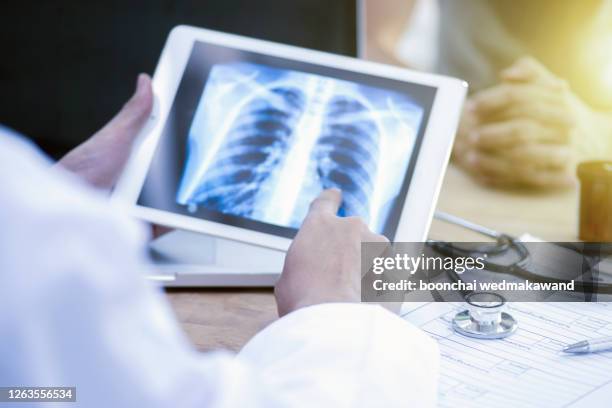 doctor looking at x-ray of lungs and writing diagnosis metadata - atmungsorgan stock-fotos und bilder
