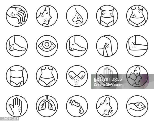 illustrations, cliparts, dessins animés et icônes de ensemble d’icônes d’allergie de peau - coup de soleil