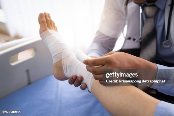 broken leg patient on the bed ,doctor or physiotherapist giving the expert treatment to the broken leg patient on the bed for a good recovery,patient with knee problem at consulting room - ankle sprain stock-fotos und bilder