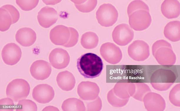 red blood cells (erythrocytes), white blood cell (lymphocyte) and platelets (thrombocytes) normal human blood smear, wright's stain, 400x - platelet stock-fotos und bilder