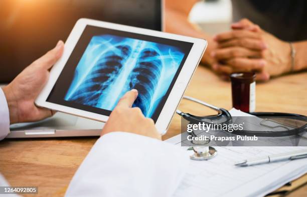 lung cancer concept. doctor explaining results of lung check up from x-ray scan chest on digital tablet screen to patien - cancer screening stock-fotos und bilder