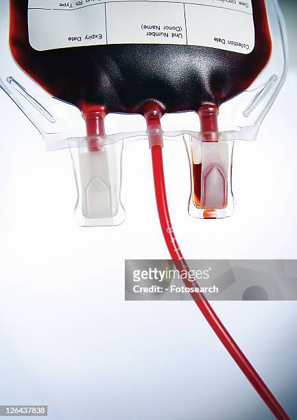 blood bag, bottle, dosage, dose - blood tubes stockfoto's en -beelden