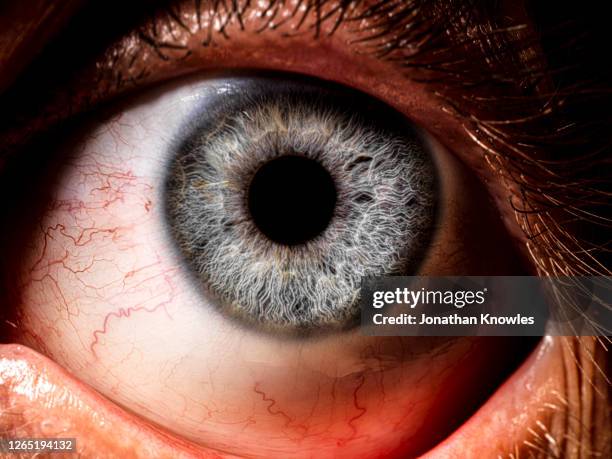 close up bloodshot blue eye - blue iris eye stock pictures, royalty-free photos & images