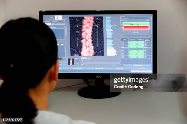 Medix 90 a tool for routine osteoporosis and fracture risk assessment. Cardiology hospital. Ho Chi Minh City. Vietnam.