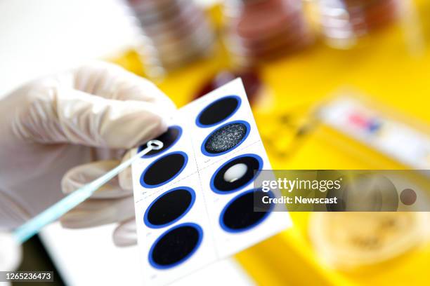 Blood poisoning bacteria colonies being cultured on an agar medium.