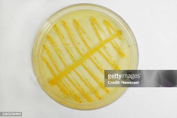 Coli sample taken from urine E.Coli is a leading cause of foodbourne illness and found in the lower gastrointestinal tract of warm blooded animals,...