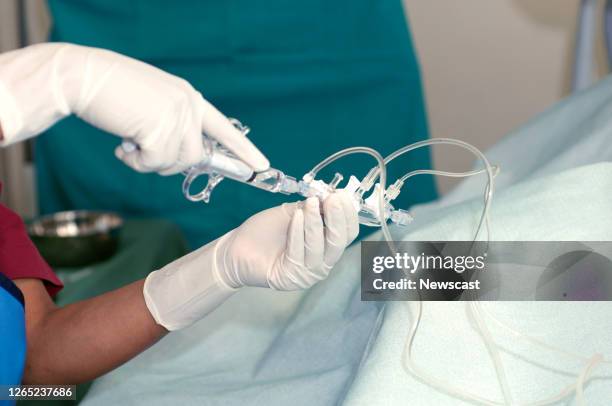 The control syringe and three-way manifold that is used during trans-radial angiography. The manifold is used to administer the contrast medium as...
