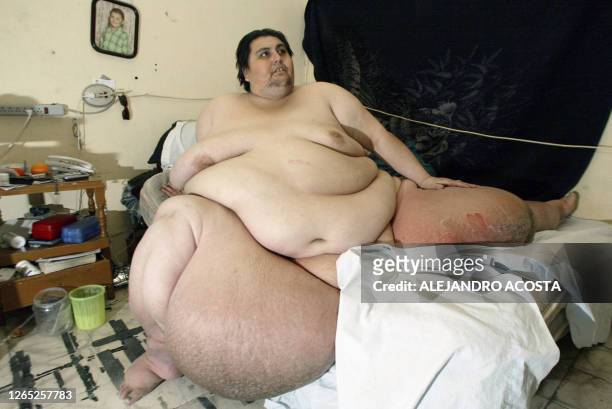 Manuel Uribe with a weight of 550 kilos who suffers a morbid obesity, that can finish in death, for almost 20 years, poses 17 January 2006 in San...