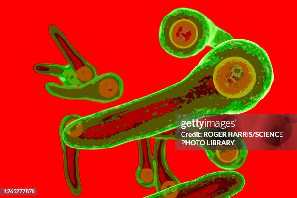 corynebacterium diphtheriae bacteria, illustration - corynebacterium diphtheriae stock illustrations