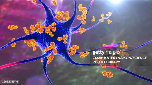 illustrations, cliparts, dessins animés et icônes de antibodies attacking neurons, conceptual illustration - sclérose en plaques