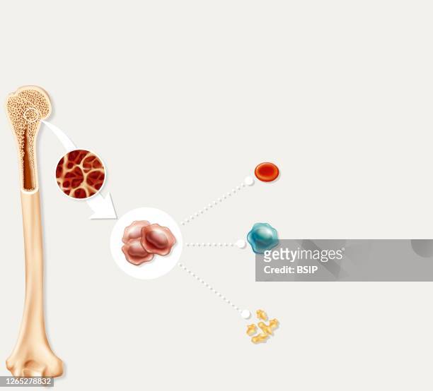 Bone marrow, stem cells, hematopoiesis. The bone marrow is located in the bones, mainly in the sternal bones, the iliac bones and the head of the...