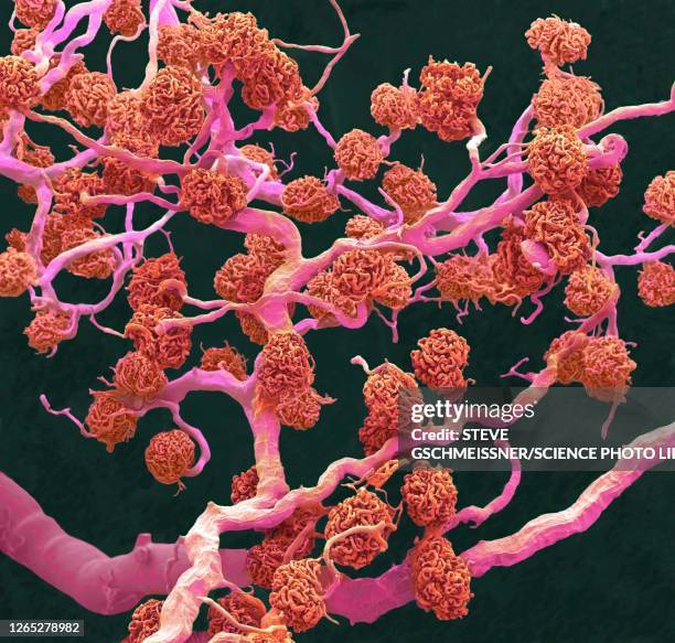 kidney glomeruli, sem - capillary body part stock pictures, royalty-free photos & images