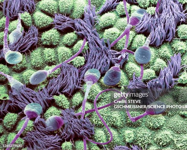 sperm in a fallopian tube, sem - electron micrograph stock pictures, royalty-free photos & images