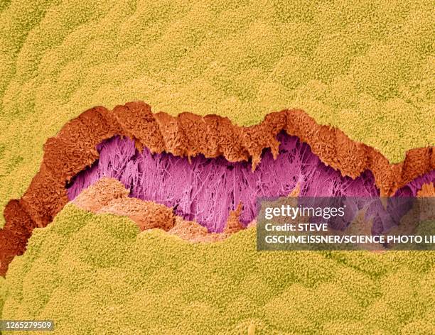 gall bladder, sem - micrografia elettronica a scansione foto e immagini stock