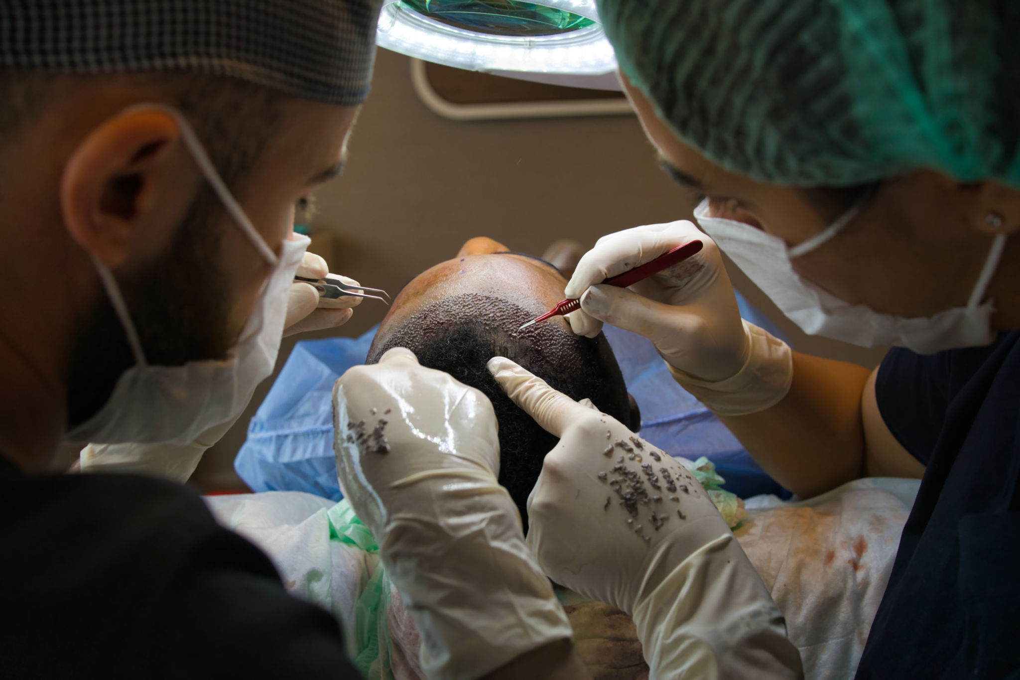 hair transplant clinic