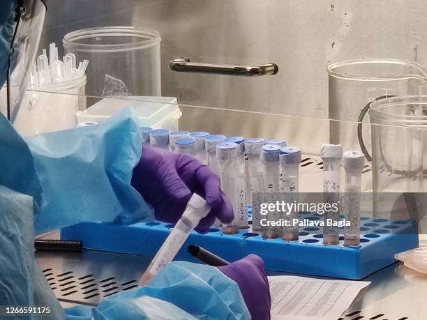Researchers conduct Corona virus diagnostic tests on August 13,2020 at the Translational Health Science Technology Institute in Faridabad, India....