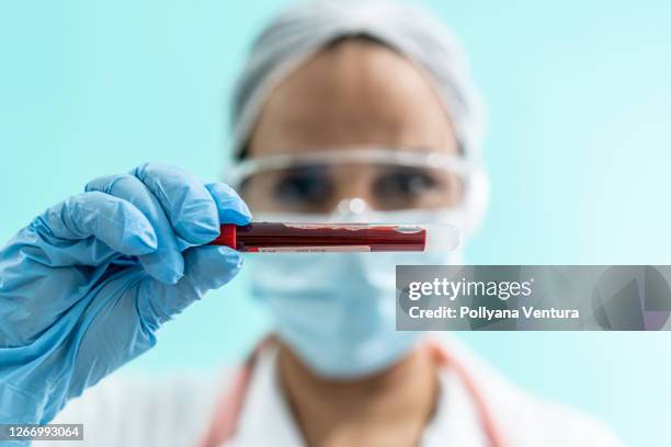 campione di sangue - ematologia foto e immagini stock