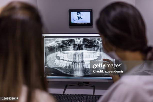 dentist shows patient the results of the dental procedure - ficha-dentária imagens e fotografias de stock