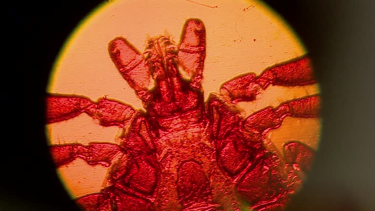 Inset Microscope 352 Insect Under The Microscope Stock Videos, Footage, & 4K Video Clips ...