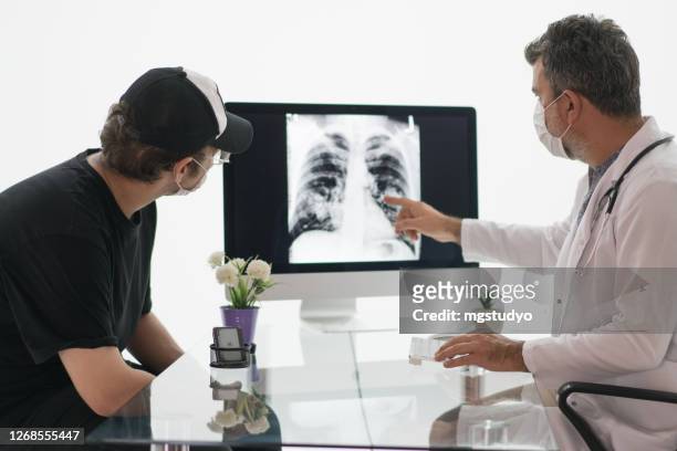 mature male doctor looks at a radiograph of a chest with his patient. - human lung stock pictures, royalty-free photos & images