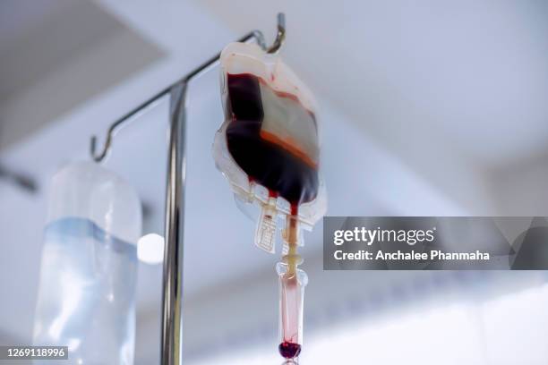 medical concept; close up picture of the blood bag hanging on the rail in the hospital - blood bag stock pictures, royalty-free photos & images