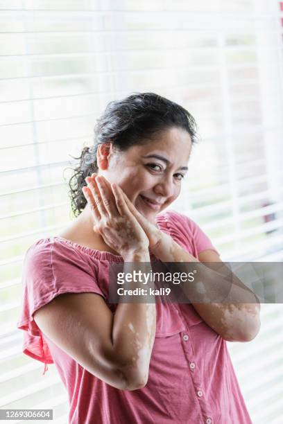mature mixed-race woman with vitiligo - mottled skin stock pictures, royalty-free photos & images