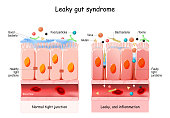 Leaky gut Syndrome