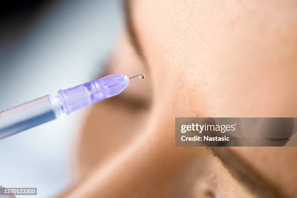 hyaluronsäure-behandlung, injektion von flüssigkeit in die menschliche haut - botox injections stock-fotos und bilder