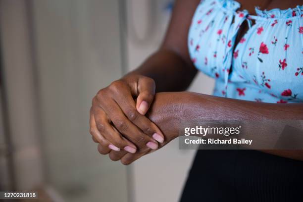 young woman moisturising her hands and arm with cream - dry skin - fotografias e filmes do acervo