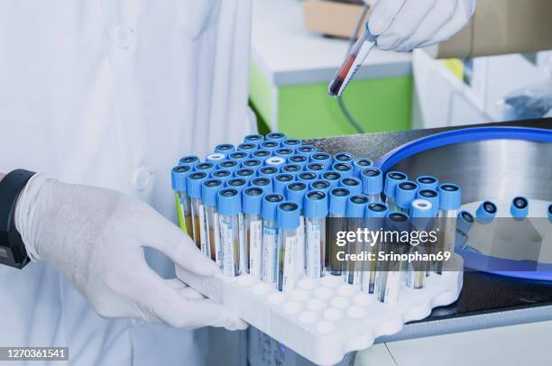 Medical Device Sampling Methods 977 Samples And Sampling Techniques Stock Photos, High-Res Pictures ...