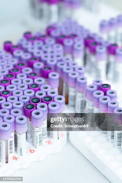 Medical Device Sampling Methods 1,178 Samples And Sampling Techniques Stock Photos, High-Res Pictures ...