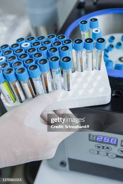 Medical Device Sampling Methods 5,605 Medical Sample Collection Stock Photos, High-Res Pictures, and ...