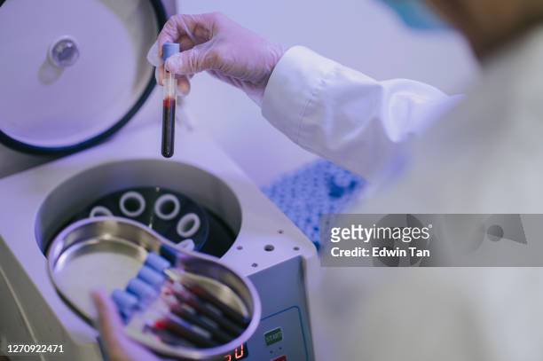 美容師は、血液採取管を保持する遠心分離機機を使用して血小板豊富な血漿療法に取り組むprp療法アジアの中国人看護師を行います - 人間の血液 ストックフォトと画像