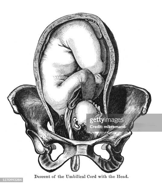 old engraved illustration of different positions of the fetus in womb - biomedical illustration stock pictures, royalty-free photos & images